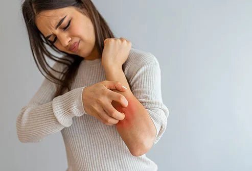 5 důvodů, proč si koupit hypoalergenní šperky bez obsahu niklu - Zovero